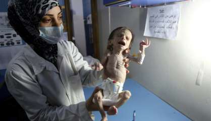 Syrie: dans la Ghouta assiégée, la mort rôde autour d'enfants malnutris